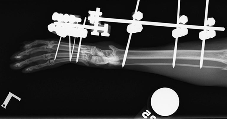 Orthopaedics: focusing on feline hock injuries