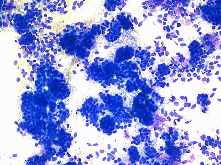 Cytology findings from a skin nodule in adult dog