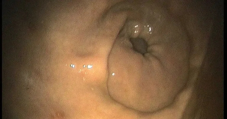 Latest research on equine glandular gastric disease