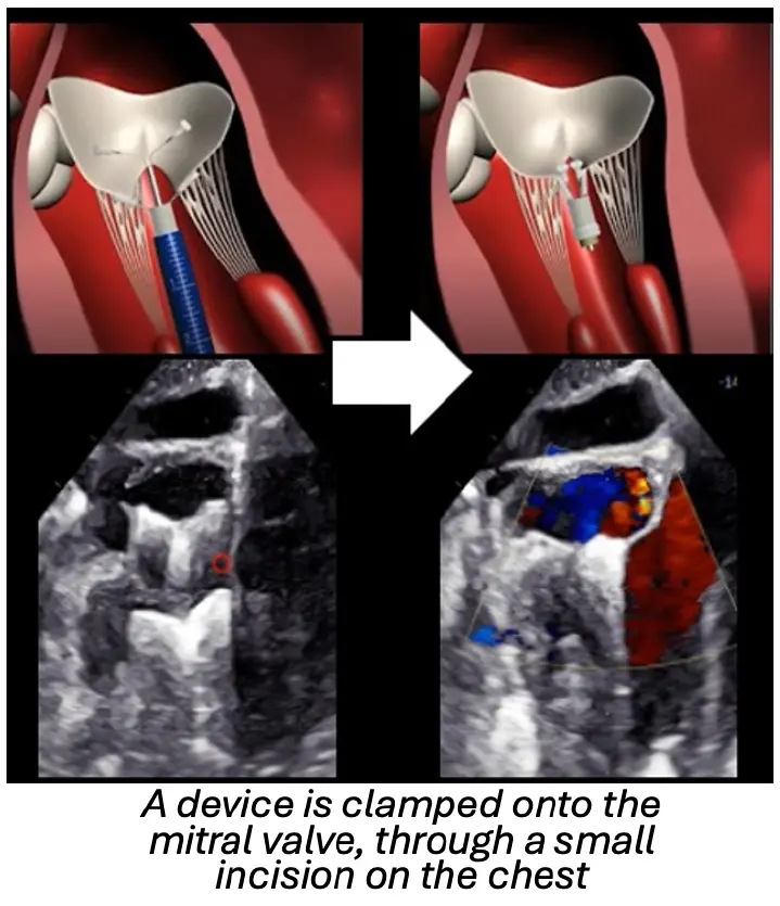 RVC unveils ‘world first’ canine heart disease treatment offer