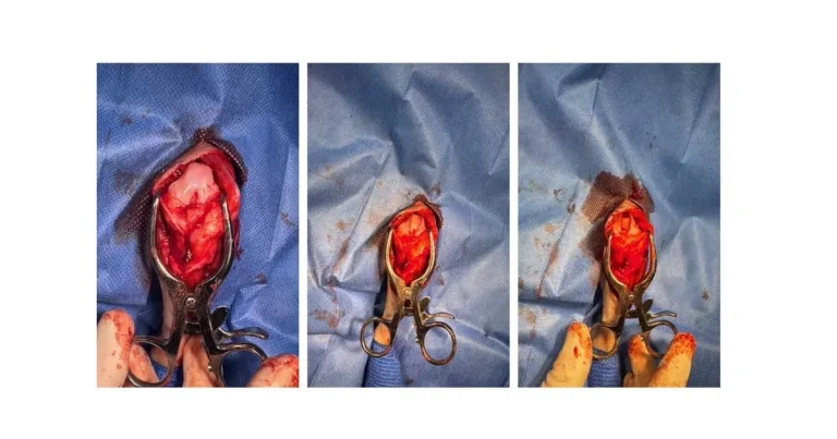 Canine patellar luxation – surgical options and outcomes