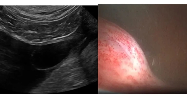 Ectopic ureters in male dogs