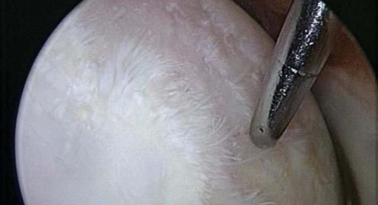 Arthroscopy – advances in diagnostics and treatment