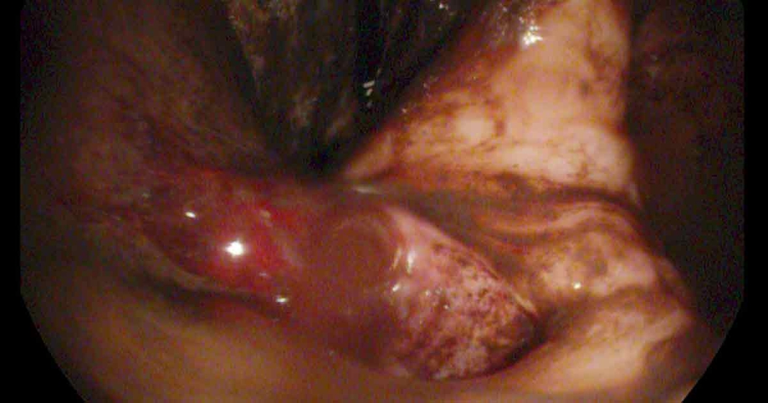 Gastrointestinal disorders in dogs