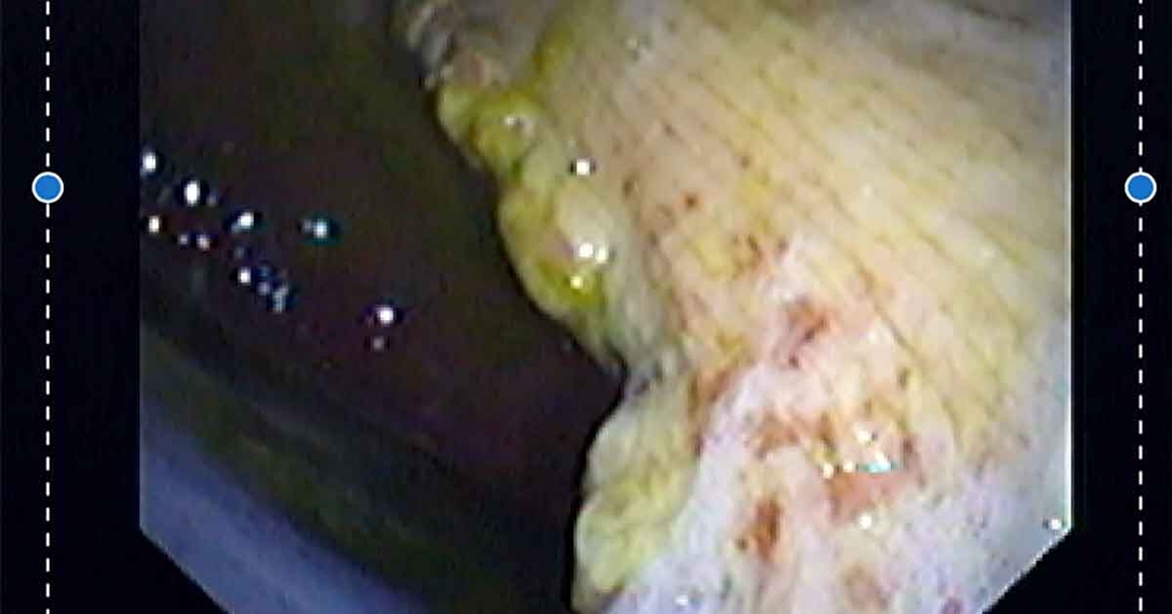 Update on diagnostics, prognosis and treatment of gastric conditions