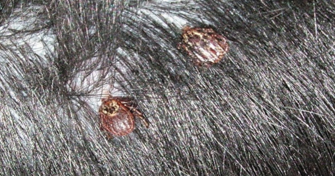 Tackle Ticks: Babesiosis