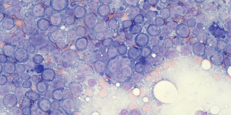 Immunophenotyping of canine lymphoma via flow cytometry