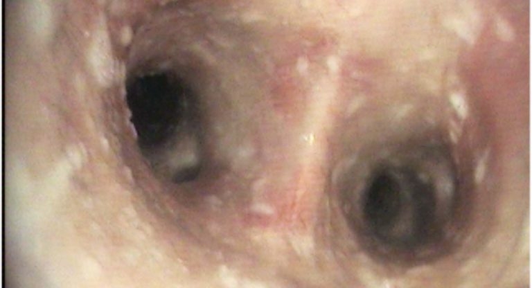 Multiple effects of clenbuterol in equine respiratory disease