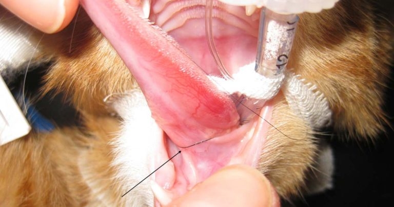 Intestinal linear foreign body