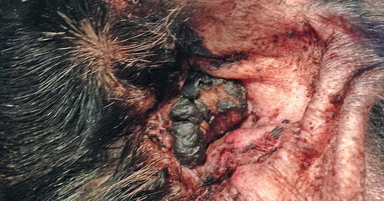 Otitis externa and otitis media: treating a common challenge