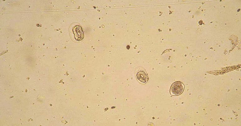 Helminth control programmes for equine yearlings at pasture