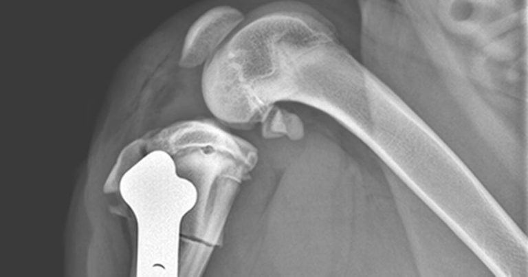 Managing canine cranial cruciate ligament avulsion