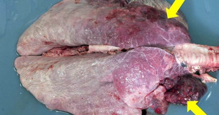 BVD update: clinical disease transmission and eradication