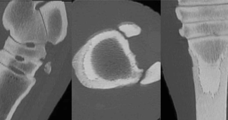 Wound management: effective treatment factors and strategies
