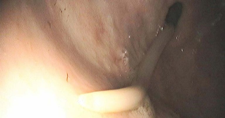 Equine worming: how to get most from egg count tests