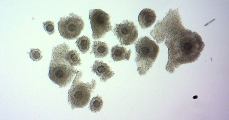 Transvaginal OPU and IVFEP part 2: future of bovine genetics?