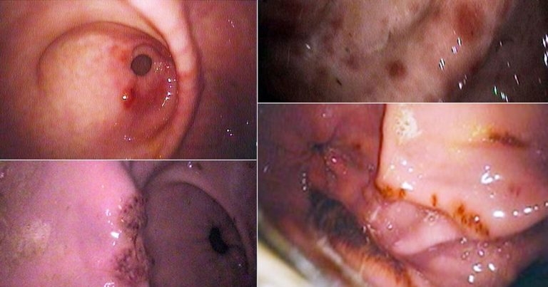 Equine gastric squamous and glandular disease update