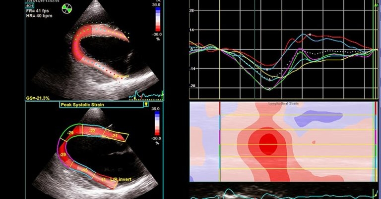 Equine cardiology: common issues and diagnostic advice