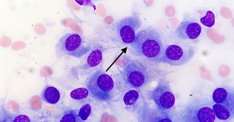 Large shoulder mass in a dog