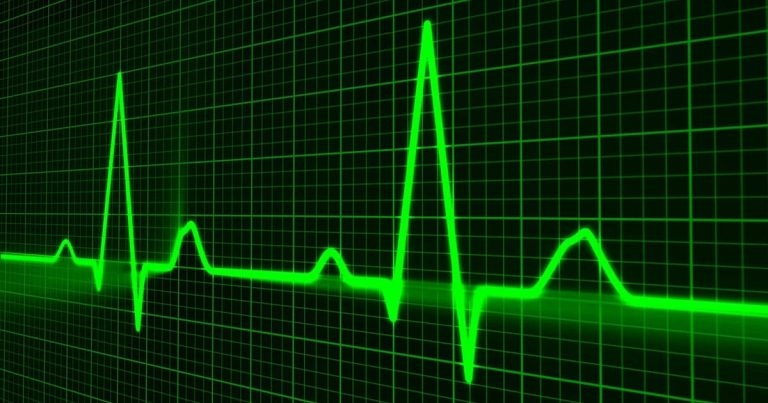 Prevalence of right ventricular abnormalities in cats with HCM