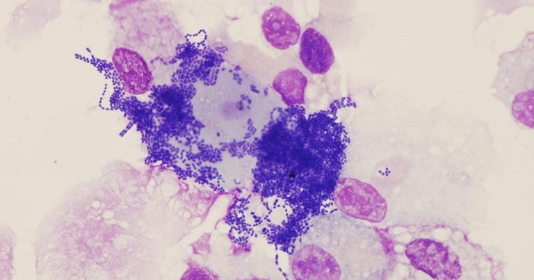 Investigating lower airway disease: part 1