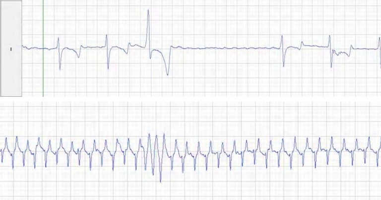 Equine cardiac abnormalities: impact on performance, safety and life expectancy