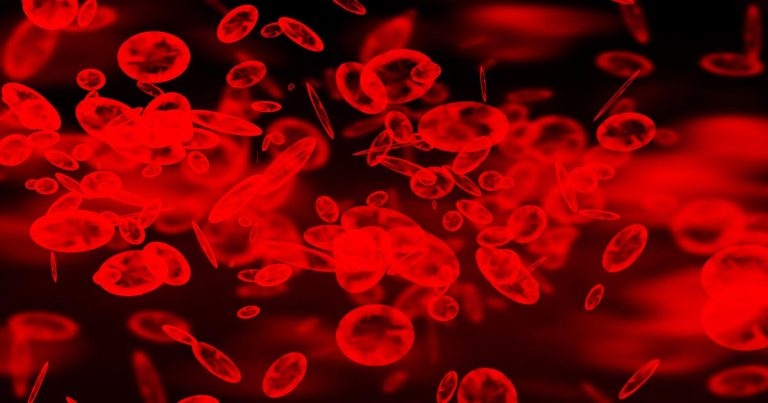 Diagnosing immune-mediated thrombocytopenia in a dog