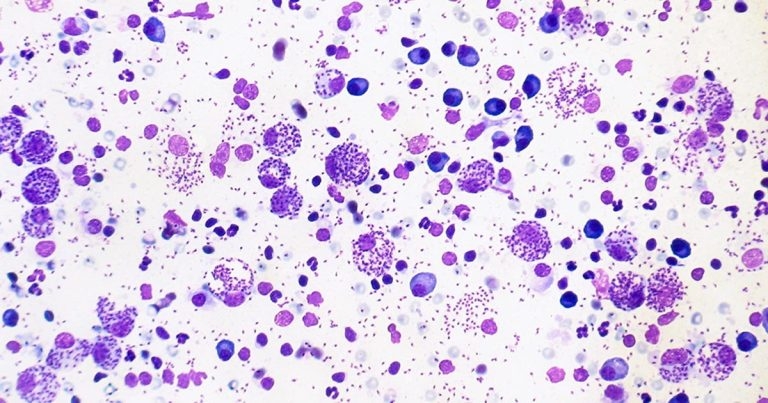 Case study of generalised lymphadenopathy in a dog