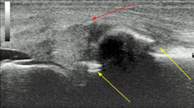 Common disorders of equine joints: causes to treatment
