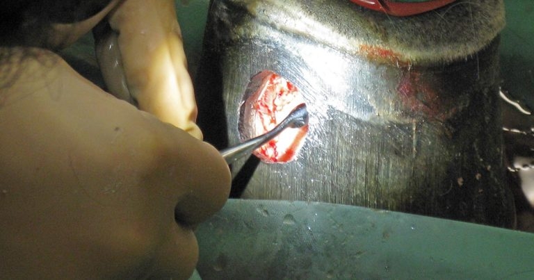 Understanding pedal osteitis