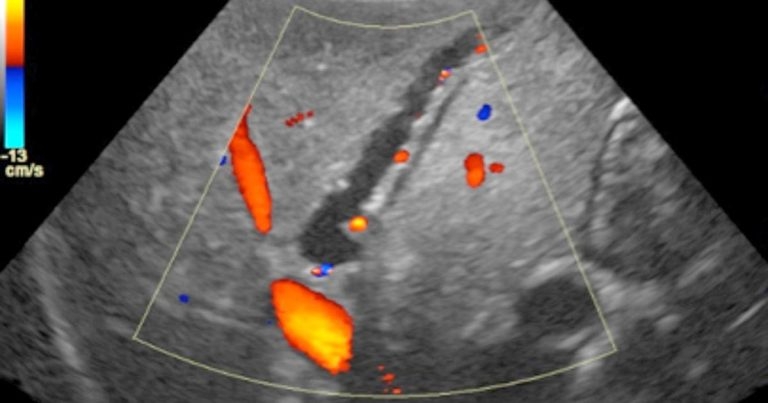 Gall bladder mucocele in a dog