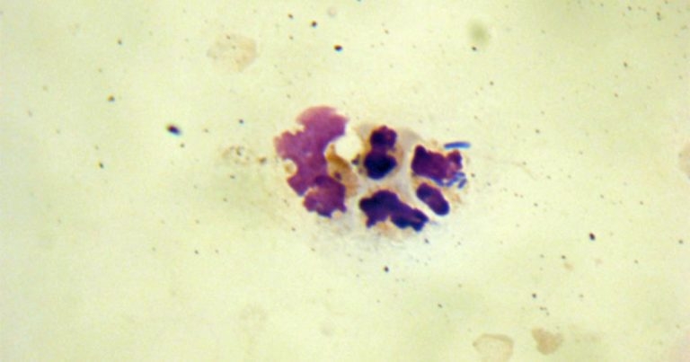 Urinary tract infection in dogs – signs, causes and treatment