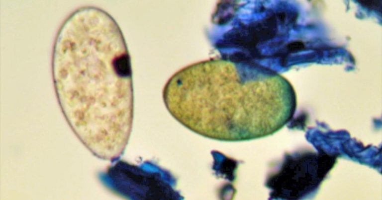 Liver fluke in cattle and sheep: control and treatment of acute cases