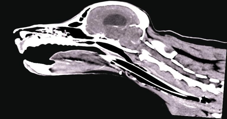Interventional radiology