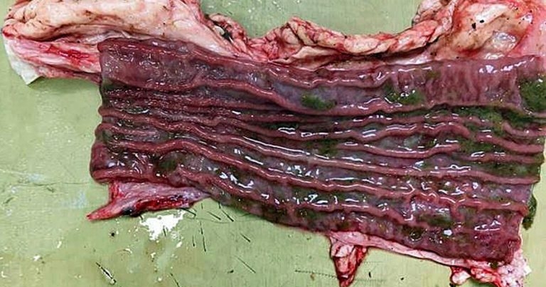 Impact and control of liver and rumen fluke: current state of play