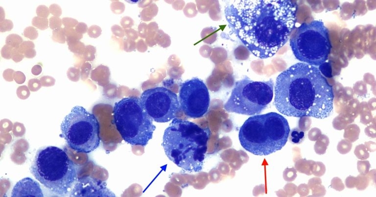 Mass on thoracic limb of a dog