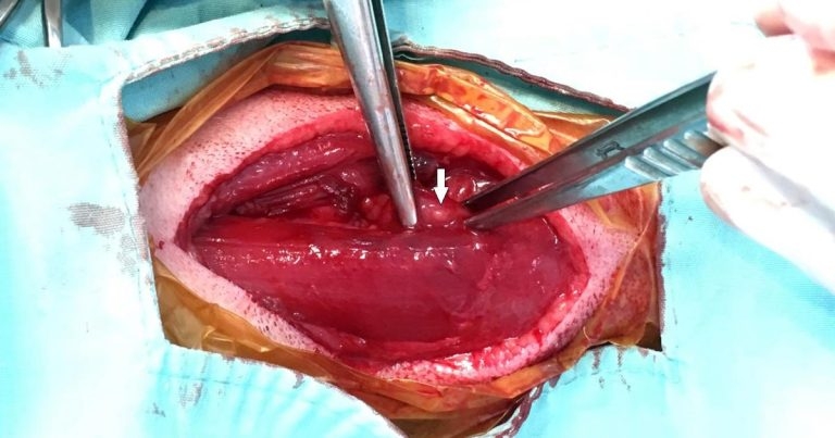 Case of canine primary hyperparathyroidism