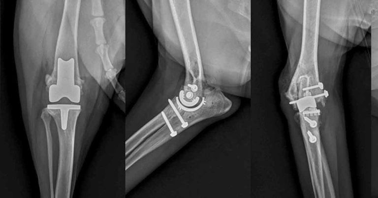 OA treatment and management part 1: pathophysiology of pain