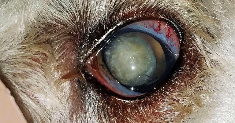 Glaucoma: treatment of a leading and painful cause of blindness