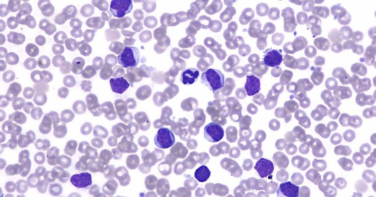 Dog with peripheral leukocytosis