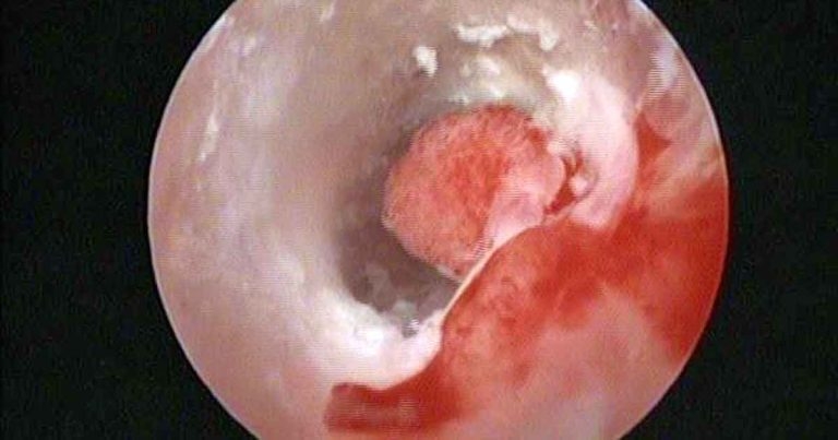 Treatment of canine otitis externa – latest thinking