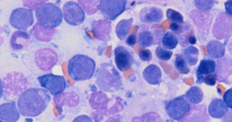 Precursor targeted immune mediated haemolytic anaemia