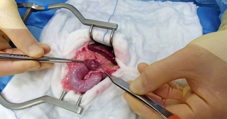 What’s your diagnosis in this case?