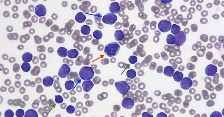 Unexpected findings in a dog with peripheral leukocytosis