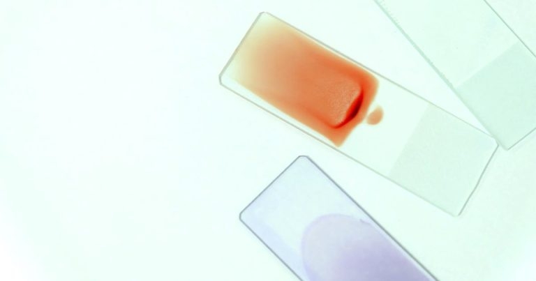 Cytology tips: cellularity