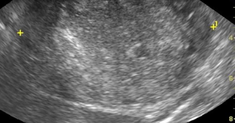 Identifying chronic kidney disease in dogs and cats