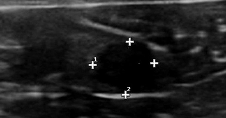 Case of suspected insulin-resistant diabetes mellitus in a border collie