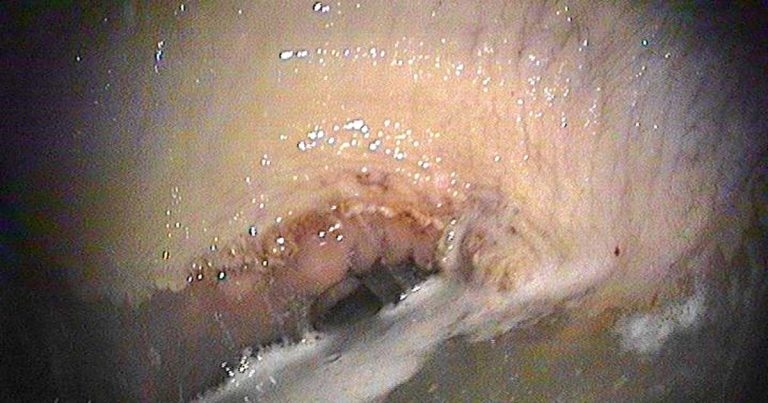 Gastric ulceration in equine patients – risk factors, testing and treatment