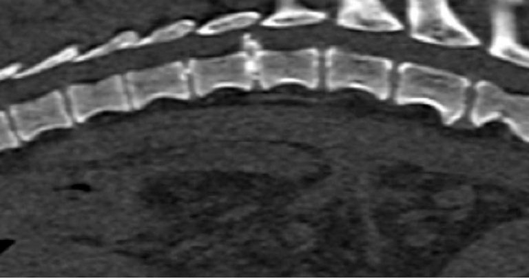Genetics of disc disease in chondrodystrophic dogs