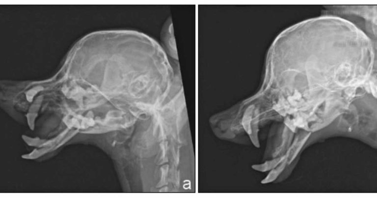 Update in mandibular and maxillary fracture management